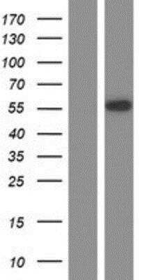 Western Blot: POU2F2 Overexpression Lysate (Native) [NBP2-10845] - POU2F2 Overexpression Lysate (Native) Left-Empty vector transfected control cell lysate (HEK293 cell lysate); Right -Over-expression Lysate for Oct2.