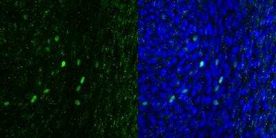 Immunohistochemistry-Frozen: POU2F3 Antibody [NBP1-83966] - Analysis of human airway cell line using POU2F3 antibody. Nuclear staining with DAPI. Image overlap in right panel. IHC-Fr image submitted by a verified customer review.