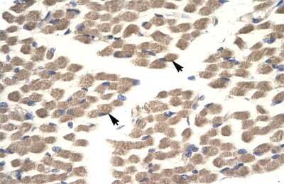 Immunohistochemistry POU2F3 Antibody - BSA Free