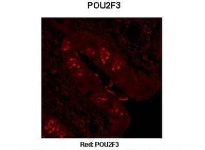 Immunohistochemistry POU2F3 Antibody - BSA Free