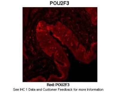 Immunohistochemistry: POU2F3 Antibody [NBP2-88075] - Sample Type: Mouse tongue tissue. Primary Antibody Dilution: 1:100. Secondary Antibody: Anti-rabbit-Cy3. Secondary Antibody Dilution: 1:500. Color/Signal Descriptions: Red: POU2F3. Gene Name: POU2F3. Submitted by: Dr. Hong Wang, Monell Chemical Senses Cen