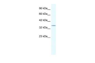 Western Blot: POU2F3 Antibody [NBP2-88075] - WB Suggested Anti-POU2F3 Antibody. Titration: 1.25 ug/ml. Positive Control: HepG2 Whole Cell