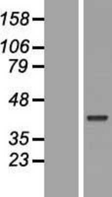 Western Blot: POU5F2 Overexpression Lysate (Adult Normal) [NBL1-14621] Left-Empty vector transfected control cell lysate (HEK293 cell lysate); Right -Over-expression Lysate for POU5F2.