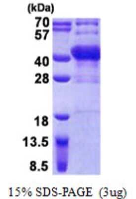 SDS-PAGE Recombinant Human POU6F1 His Protein