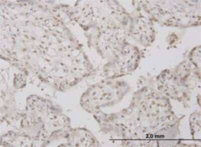 Immunohistochemistry-Paraffin: PP1 Inhibitor-2 Antibody (2E9) [H00005504-M01] - Analysis of monoclonal antibody to PPP1R2 on formalin-fixed paraffin-embedded human placenta. Antibody concentration 3 ug/ml.