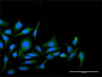 Immunocytochemistry/Immunofluorescence: PP1 Inhibitor-2 Antibody [H00005504-D01P] - Analysis of antibody to PPP1R2 on HeLa cell. Antibody concentration 20 ug/ml.