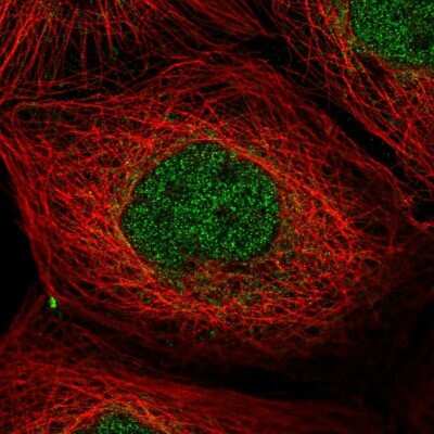 Immunocytochemistry/Immunofluorescence: PP1 Inhibitor-2 Antibody [NBP2-48801] - Immunofluorescent staining of human cell line A-431 shows localization to nucleoplasm & cytosol.