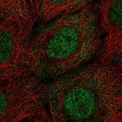 Immunocytochemistry/Immunofluorescence: PP1 Inhibitor-2 Antibody [NBP2-56881] - Staining of human cell line A-431 shows localization to nucleoplasm.