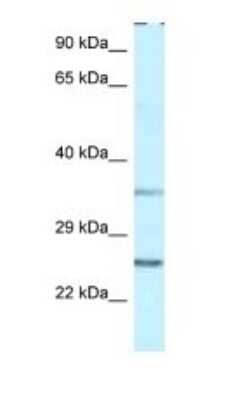 Western Blot: PP1 Inhibitor-2 Antibody [NBP1-79889] - Titration: 1.0 ug/ml Positive Control: THP-1 Whole Cell.