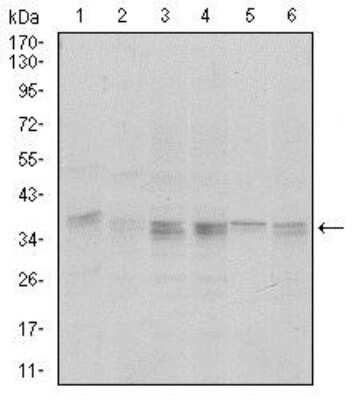 Western Blot: PP1 alpha/PPP1A Antibody (5E9) [NBP2-37531] - Western blot analysis using PPP1CA mouse mAb against Hela (1), HepG2 (2), MCF-7 (3), Jurkat (4) and A549 (5) cell lysate.