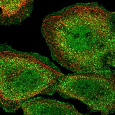 Immunocytochemistry/Immunofluorescence: PP1 alpha/PPP1A Antibody [NBP2-38559] - Staining of human cell line A-431 shows localization to nucleoplasm, plasma membrane & cytosol. Antibody staining is shown in green.