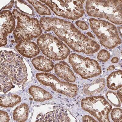 Immunohistochemistry-Paraffin: PP1 alpha/PPP1A Antibody [NBP2-38559] - Staining of human kidney shows strong cytoplasmic positivity in renal tubules.