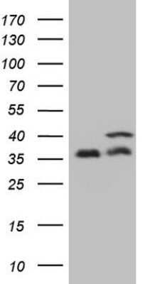 Western Blot: PP1 alpha/PPP1A Antibody (OTI6E5) - Azide and BSA Free [NBP2-73542] - Analysis of HEK293T cells were transfected with the pCMV6-ENTRY control (Left lane) or pCMV6-ENTRY PPP1CA.