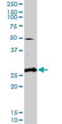 Western Blot: PP14/Glycodelin Antibody [H00005047-D01P] - Analysis of PAEP expression in human placenta.