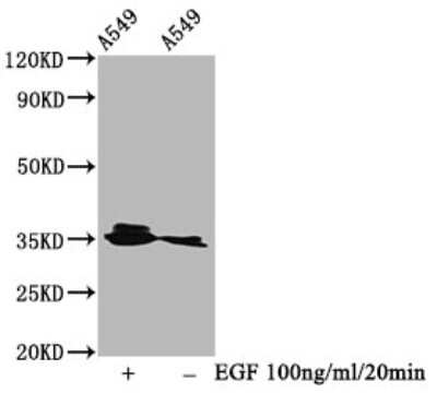 Western Blot: PP2A alpha [p Tyr307] Antibody (3F11) [NBP3-15142] - Positive WB detected in A549 whole cell lysate (treated with EGF or not). All lanes PP2A alpha antibody at 0.95ug/ml. Secondary: Goat polyclonal to rabbit IgG at 1/50000 dilution. Predicted band size: 35 KDa. Observed band size: 35 KDa.