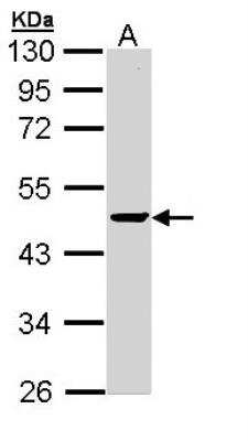 Western Blot: PP2C alpha/PPM1A Antibody [NBP1-32751] - Sample (30 ug of whole cell lysate) A: Raji  10% SDS PAGE  diluted at 1:1000