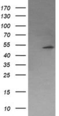 Western Blot: PP2C beta/PPM1B Antibody (OTI3C9) - Azide and BSA Free [NBP2-73548] - Analysis of HEK293T cells were transfected with the pCMV6-ENTRY control (Left lane) or pCMV6-ENTRY PPM1B.