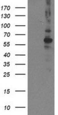 Western Blot: PP2C beta/PPM1B Antibody (OTI3F2) - Azide and BSA Free [NBP2-73547] - HEK293T cells were transfected with the pCMV6-ENTRY control (Left lane) or pCMV6-ENTRY PPM1B (Right lane) cDNA for 48 hrs and lysed. Equivalent amounts of cell lysates (5 ug per lane) were separated by SDS-PAGE and immunoblotted with anti-PPM1B.