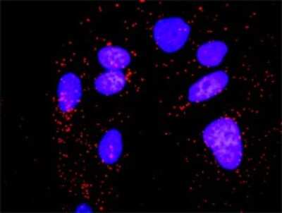 Proximity Ligation Assay: PP2C beta/PPM1B Antibody [H00005495-D01P] - Analysis of protein-protein interactions between PPM1B and CHUK. HeLa cells were stained with anti-PPM1B rabbit purified polyclonal 1:1200 and anti-CHUK mouse monoclonal antibody 1:50. Each red dot represents the detection of protein-protein interaction complex, and nuclei were counterstained with DAPI (blue).