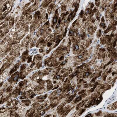 Immunohistochemistry-Paraffin: PP2C epsilon/PPM1L Antibody [NBP1-87247] - Staining of human heart muscle shows strong cytoplasmic positivity in myocytes.