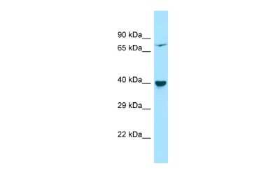 Western Blot: PP2C epsilon/PPM1L Antibody [NBP2-88077] - Host: Rabbit. Target Name: PPM1L. Sample Type: HepG2 Whole Cell lysates. Antibody Dilution: 1.0ug/ml