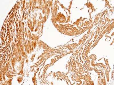 Immunohistochemistry-Paraffin: PP2C gamma/PPM1G Antibody (112) [NBP2-89858] - Staining of human PPM1G in human heart with rabbit monoclonal antibody (1:200).