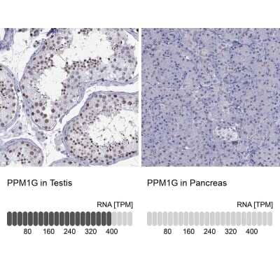 <b>Orthogonal Strategies Validation. </b>Immunohistochemistry-Paraffin: PP2C gamma/PPM1G Antibody [NBP1-87245] - Staining in human testis and pancreas tissues using anti-PPM1G antibody. Corresponding PPM1G RNA-seq data are presented for the same tissues.