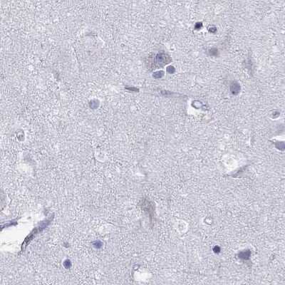 Immunohistochemistry-Paraffin: PP2C gamma/PPM1G Antibody [NBP1-87245] - Staining of human cerebral cortex.