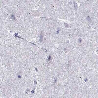 Immunohistochemistry-Paraffin: PP2C gamma/PPM1G Antibody [NBP1-87246] - Staining of human cerebral cortex.