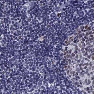 Immunohistochemistry-Paraffin: PP2C gamma/PPM1G Antibody [NBP1-87246] - Staining of human lymph node.