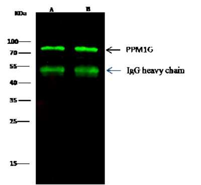 Immunoprecipitation: PP2C gamma/PPM1G Antibody [NBP2-99758] - PP2C gamma/PPM1G was immunoprecipitated using: Lane A: 0.5 mg Hela Whole Cell Lysate. Lane B: 0.5 mg 293T Whole Cell Lysate 2 ul anti-PP2C gamma/PPM1G rabbit polyclonal antibody and 15 ul of 50 % Protein G agarose. Primary antibody: Anti-PP2C gamma/PPM1G rabbit polyclonal antibody, at 1:100 dilution. Secondary antibody: Dylight 800-labeled antibody to rabbit IgG (H+L), at 1:5000 dilution. Developed using the Odyssey technique. Performed under reducing conditions. Predicted band size: 59 kDa. Observed band size: 72 kDa