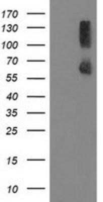 Western Blot: PP2C gamma/PPM1G Antibody (OTI1C12) - Azide and BSA Free [NBP2-73552] - HEK293T cells were transfected with the pCMV6-ENTRY control (Left lane) or pCMV6-ENTRY PPM1G (Right lane) cDNA for 48 hrs and lysed. Equivalent amounts of cell lysates (5 ug per lane) were separated by SDS-PAGE and immunoblotted with anti-PPM1G.