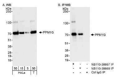 Western Blot: PP2C gamma/PPM1G Antibody [NB110-38867] - Detection of Human PPM1G on HeLa whole cell lysate (5, 15, and 50 microgram) and 293T (50 microgram) using NB110-38867. PPM1G was also immunoprecipitated by rabbit anti-PPM1G antibody NB110-38869.