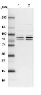 Western Blot: PP2C gamma/PPM1G Antibody [NBP1-87245] - Lane 1: NIH-3T3 cell lysate (Mouse embryonic fibroblast cells). Lane 2: NBT-II cell lysate (Rat Wistar bladder tumor cells).