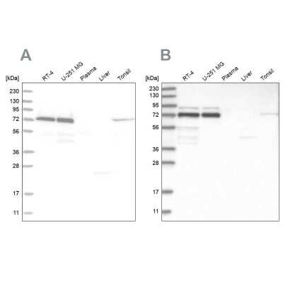 <b>Independent Antibodies Validation. </b>Western Blot: PP2C gamma/PPM1G Antibody [NBP1-87246] - Analysis using Anti-PPM1G antibody NBP1-87246 (A) shows similar pattern to independent antibody NBP1-87245 (B).