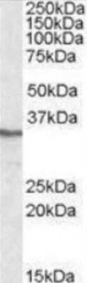 Western Blot: PP4/PPP4C Antibody [NBP1-50579] - Analysis of anti-PPP4C antibody with HEK293 lysate (35ug protein in RIPA buffer).