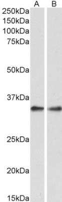Western Blot: PP4/PPP4C Antibody [NBP1-50579] - PP4/PPP4C Antibody (0.3ug/ml) staining of Rat Spleen (A) and Lung (B) lysate (35ug protein in RIPA buffer). Primary incubation was 1 hour. Detected by chemiluminescencence.