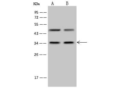 Western Blot: PP4/PPP4C Antibody [NBP2-99380] - Anti-PP4/PPP4C rabbit polyclonal antibody at 1:500 dilution. Lane A: Hela Whole Cell Lysate Lane B: HepG2 Whole Cell Lysate Lysates/proteins at 30 ug per lane. Secondary Goat Anti-Rabbit IgG (H+L)/HRP at 1/10000 dilution. Developed using the ECL technique. Performed under reducing conditions. Predicted band size: 35 kDa. Observed band size: 35 kDa