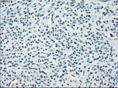 Immunohistochemistry-Paraffin: PP5 Antibody (2E12) [NBP1-47927] - Staining of paraffin-embedded Human endometrium tissue using anti-PP5 mouse monoclonal antibody.