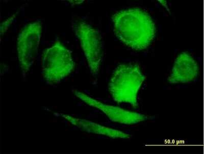 Immunocytochemistry/Immunofluorescence: PP5 Antibody [H00005536-B01P] - Analysis of purified antibody to PPP5C on HeLa cell. (antibody concentration 10 ug/ml)