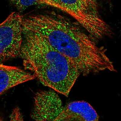 Immunocytochemistry/Immunofluorescence: PP5 Antibody [NBP1-87240] - Staining of human cell line U-251 MG shows localization to cytosol & vesicles. Antibody staining is shown in green.