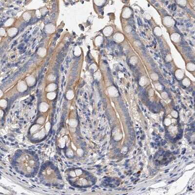 Immunohistochemistry-Paraffin: PP5 Antibody [NBP1-87240] - Staining of human colon shows weak cytoplasmicand moderate membranous positivity in glandular cells.