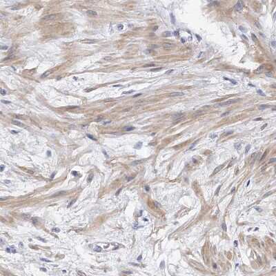 Immunohistochemistry-Paraffin: PP5 Antibody [NBP1-87240] - Staining of human prostate shows weak cytoplasmic positivity in smooth muscle cells.