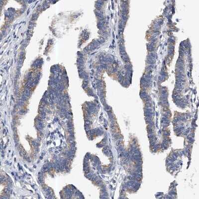 Immunohistochemistry-Paraffin: PP5 Antibody [NBP1-87240] - Staining of human fallopian tube shows moderate cytoplasmic positivity in glandular cells.