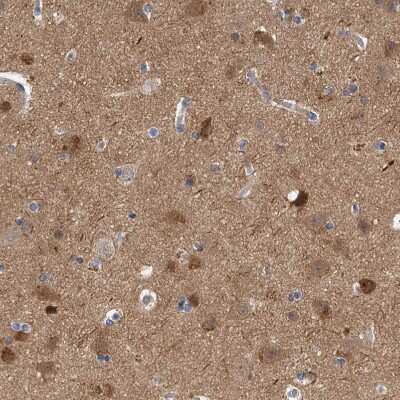 Immunohistochemistry-Paraffin: PP5 Antibody [NBP1-87240] - Staining of human cerebral cortex shows moderate cytoplasmic positivity in a subset of neurons.