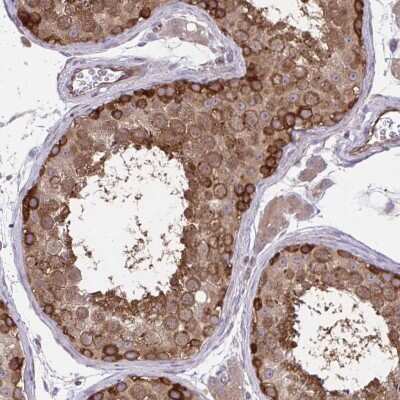 Immunohistochemistry-Paraffin: PP5 Antibody [NBP2-38812] - Staining of human testis shows strong cytoplasmic positivity in cells in seminiferous ducts.