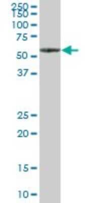 Western Blot: PP5 Antibody [H00005536-B01P] - Analysis of PPP5C expression in human liver.