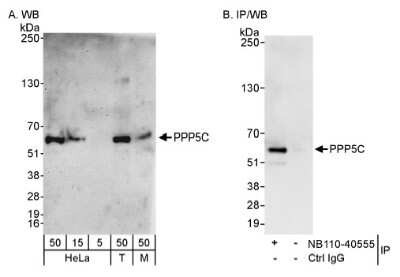 Western Blot: PP5 Antibody [NB110-40555] - Whole cell lysate from HeLa (5, 15 and 50 mcg for WB; 1 mg for IP, 20% of IP loaded), 293T (T; 50 mcg), and mouse NIH3T3 (M; 50 mcg) cells. NB110-40555 used for WB at 0.04 mcg/ml (A) and 1 mcg/ml (B) and used for IP at 3 mcg/mg lysate (B).