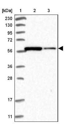 Western Blot: PP5 Antibody [NBP1-87240] - Lane 1: Marker  [kDa] 230, 130, 95, 72, 56, 36, 28, 17, 11.  Lane 2: Human cell line RT-4.  Lane 3: Human cell line U-251MG sp