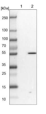 Western Blot: PP5 Antibody [NBP1-87240] - Lane 1: NIH-3T3 cell lysate (Mouse embryonic fibroblast cells). Lane 2: NBT-II cell lysate (Rat Wistar bladder tumor cells).